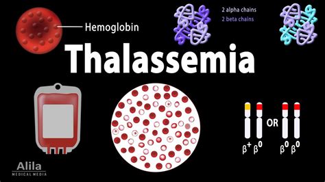 beta thalassemia hemoglobin|Alpha thalassemia: Symptoms and treatment .